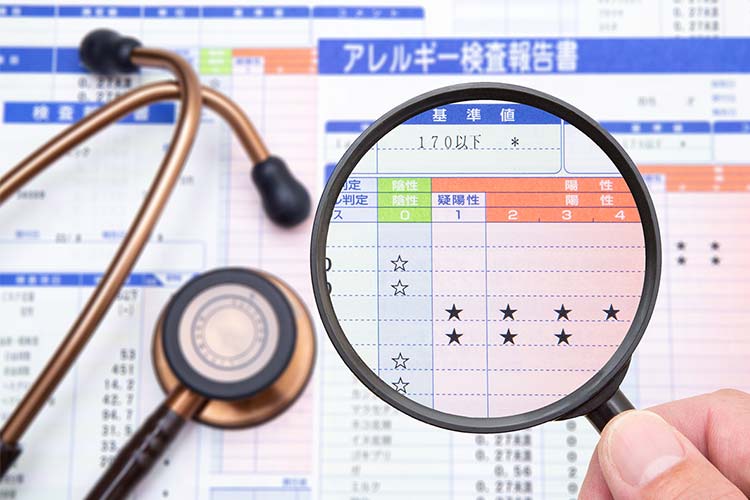 アレルギー科