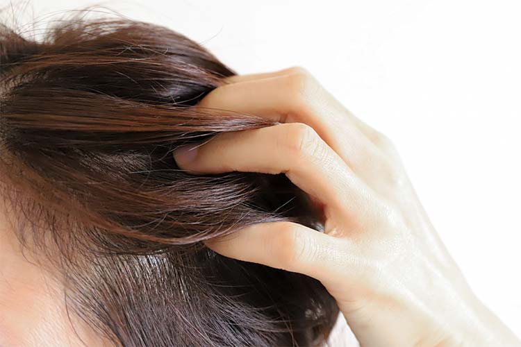 毛が抜ける・汗が多いとき