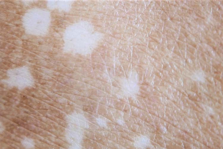 皮膚の色が気になる